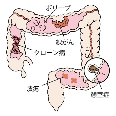 大腸方向 陰毛 用途